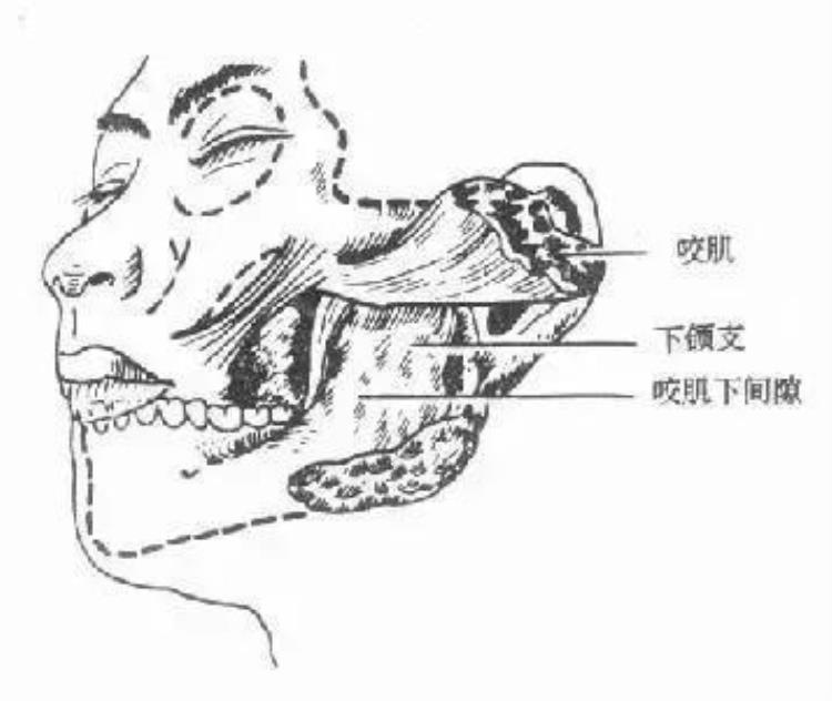 同样是咬肌为什么你的就很大别人就不大