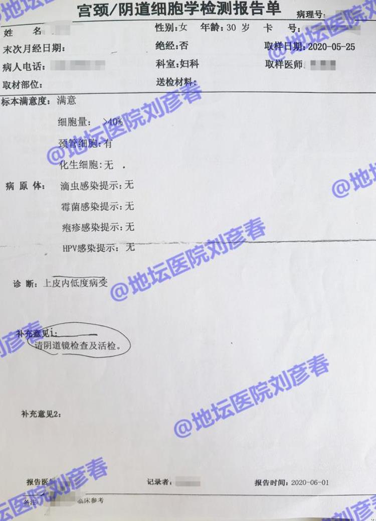 病例分享TCT检测显示中度炎症怎么办需要治疗吗