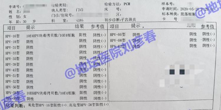 病例分享TCT检测显示中度炎症怎么办需要治疗吗