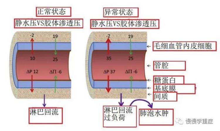 肺水肿 百科,怎么知道自己得了肺水肿