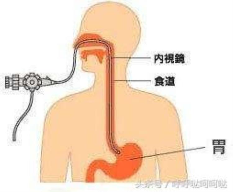 做胃镜一般多少钱,2023年胃镜价格