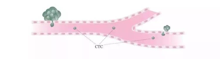 老被医生要求做得ctc检测究竟该不该做,健康人有必要查ctc吗