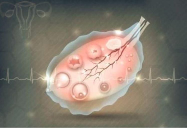 试管促排卵泡会自己排掉吗「试管促排卵泡会自己排掉吗」