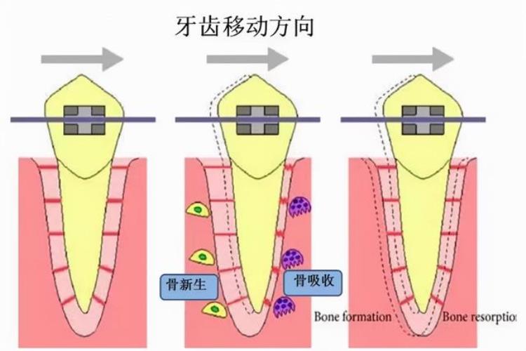 牙根痒痒老想咬东西是怎么回事啊「牙根痒痒老想咬东西是怎么回事」