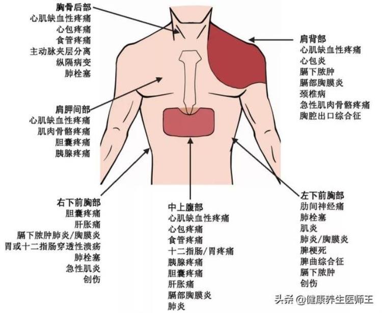 健康之路胸痛「生命健康之胸痛」