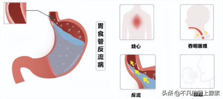 胸口疼可能是这5个原因吗「胸口疼可能是这5个原因」