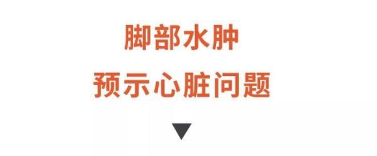 长期水肿的危害「长期水肿勿忽视可能是身体在报警这4种尤其危险」