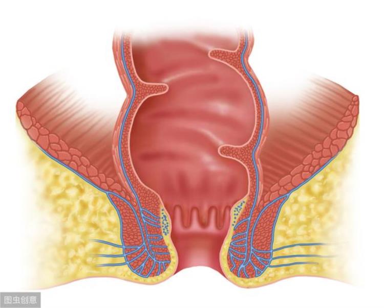 肛裂手术后大便滴血不会裂吧「肛裂手术后排便疼痛出血大便失禁会找上你吗」