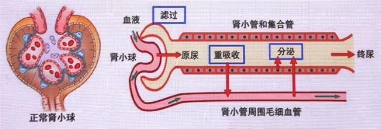 水肿尤重于肾「好言相劝水肿往往是肾病的急先锋肾病专家一文给您解读」