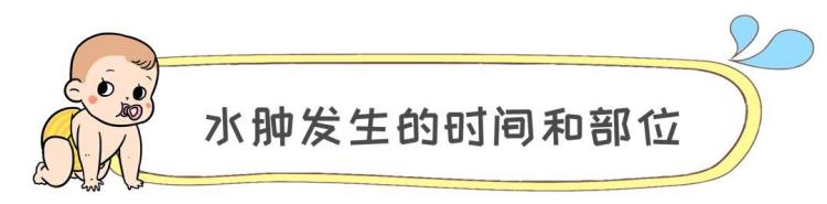 孕期水肿的原因怎么缓解「孕期水肿多是这3个原因所致学会这6招分分钟缓解水肿」