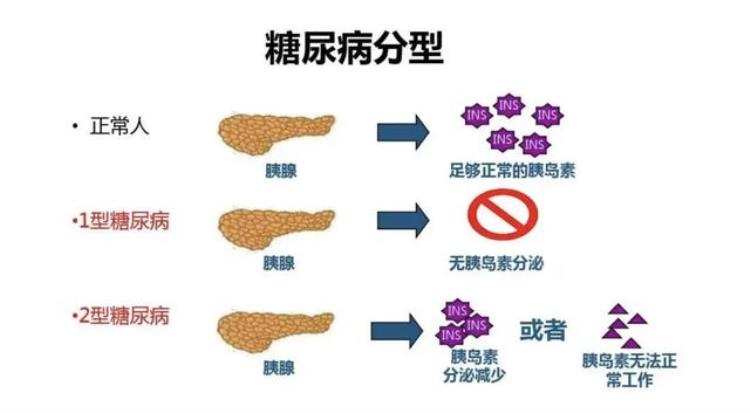 针对糖尿病人的保险「两亿糖尿病人的福音能投的保险来了」