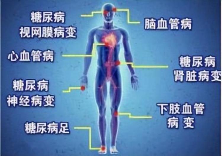 针对糖尿病人的保险「两亿糖尿病人的福音能投的保险来了」