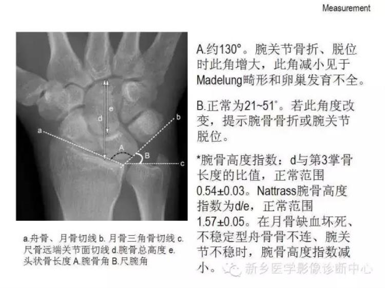 腕关节x线报告模板「详细的腕关节X线解剖摄影技巧阅片技巧测量」