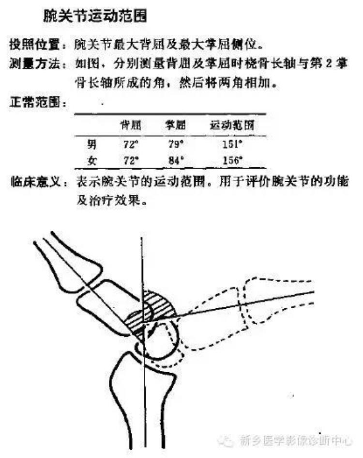 腕关节x线报告模板「详细的腕关节X线解剖摄影技巧阅片技巧测量」