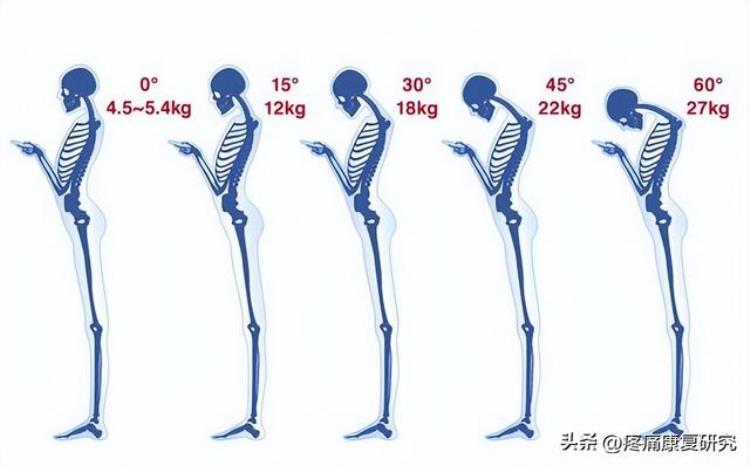 低头族与颈椎病和手腕腱鞘炎有关吗?「低头族与颈椎病和手腕腱鞘炎」