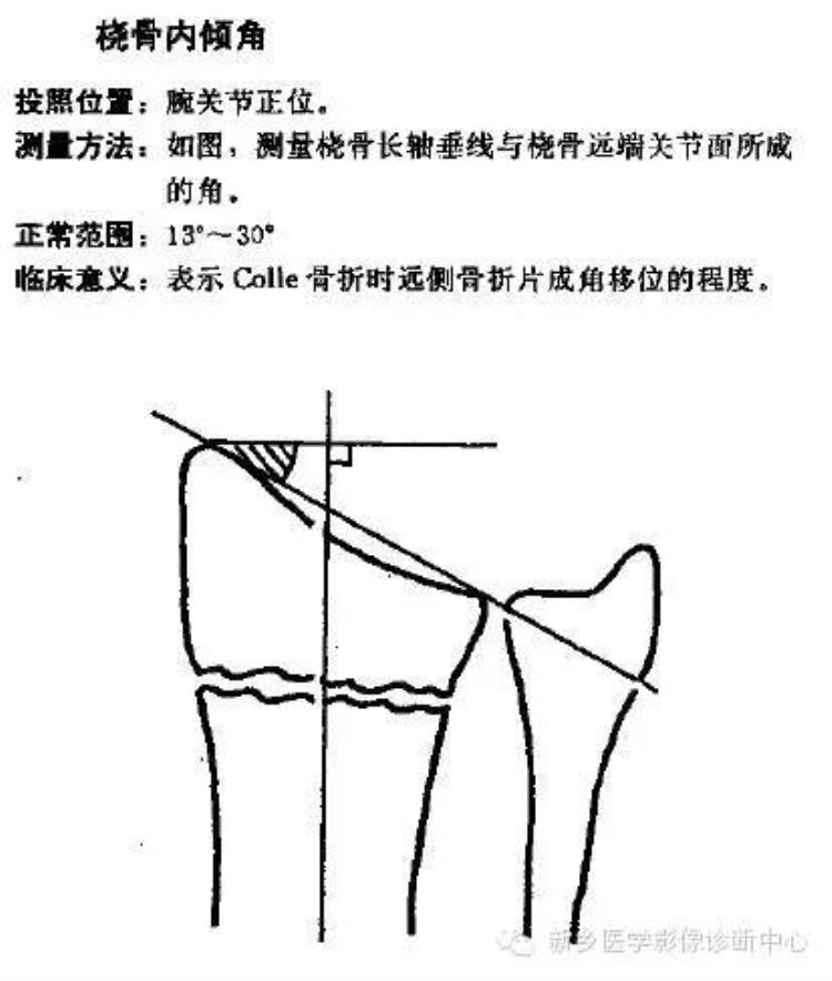 腕关节x线报告模板「详细的腕关节X线解剖摄影技巧阅片技巧测量」