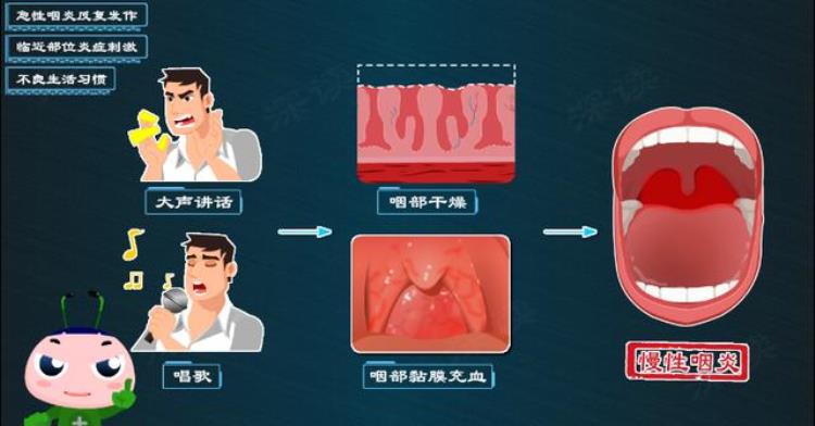 喉咙发痒干呕是怎么回事「喉咙发痒咋回事还恶心干呕生活中这件事竟能搞出慢性咽炎」