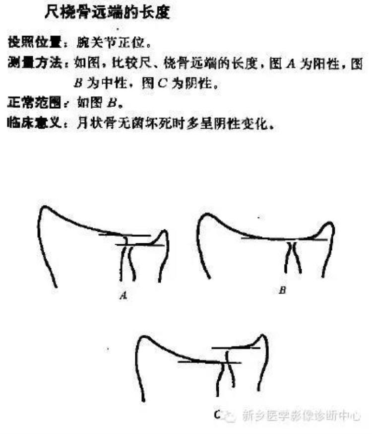 腕关节x线报告模板「详细的腕关节X线解剖摄影技巧阅片技巧测量」