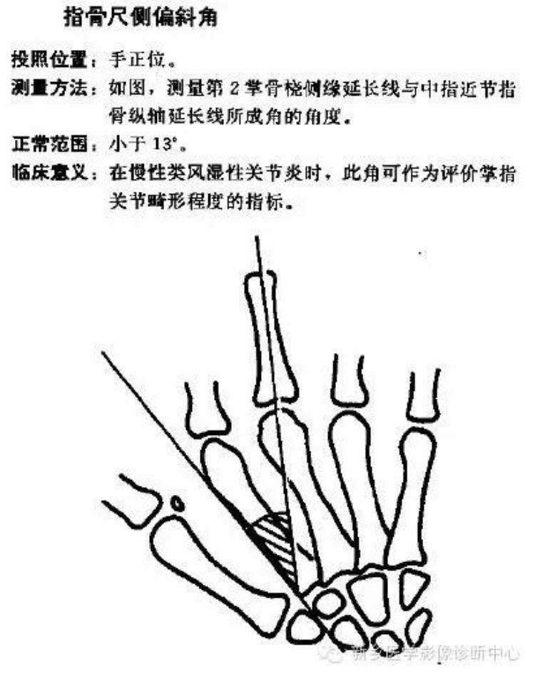 腕关节x线报告模板「详细的腕关节X线解剖摄影技巧阅片技巧测量」