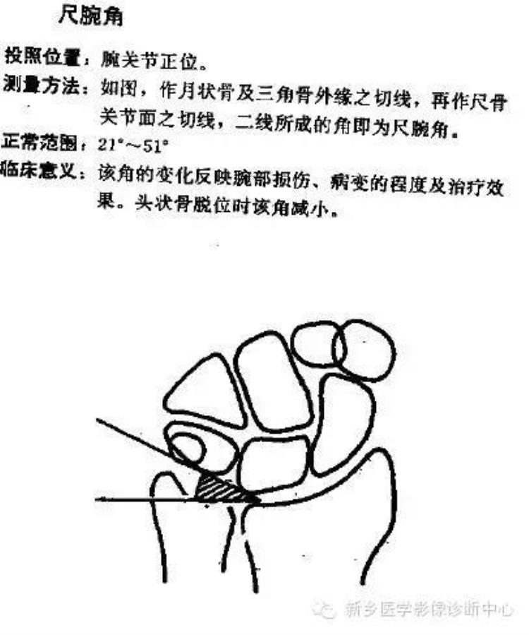 腕关节x线报告模板「详细的腕关节X线解剖摄影技巧阅片技巧测量」