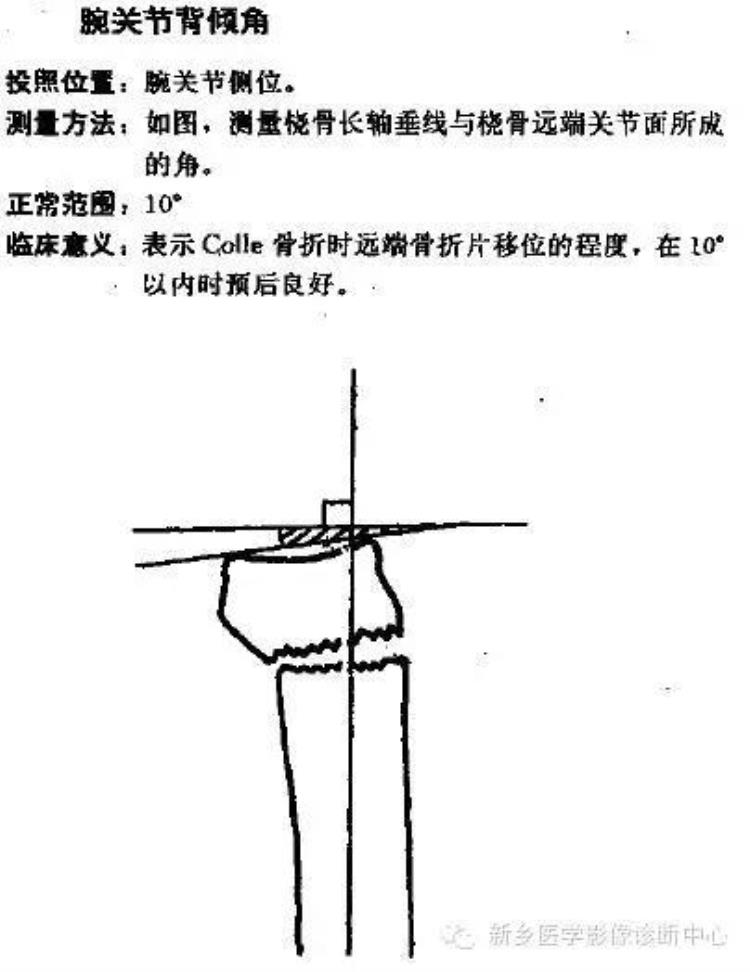 腕关节x线报告模板「详细的腕关节X线解剖摄影技巧阅片技巧测量」