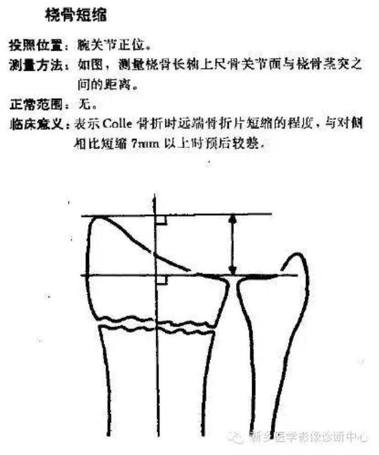 腕关节x线报告模板「详细的腕关节X线解剖摄影技巧阅片技巧测量」