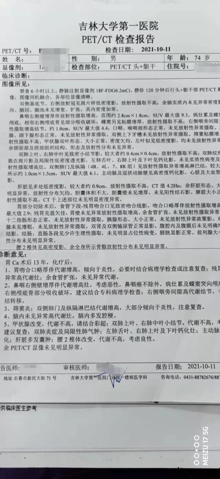 鼻子反复出血都是因为秋季干燥吗为什么「鼻子反复出血都是因为秋季干燥吗」