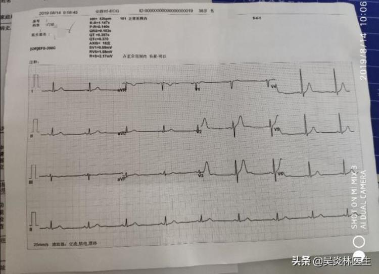 医生建议高血压患者每年必检项目为了防治并发症好好阅读一下吧