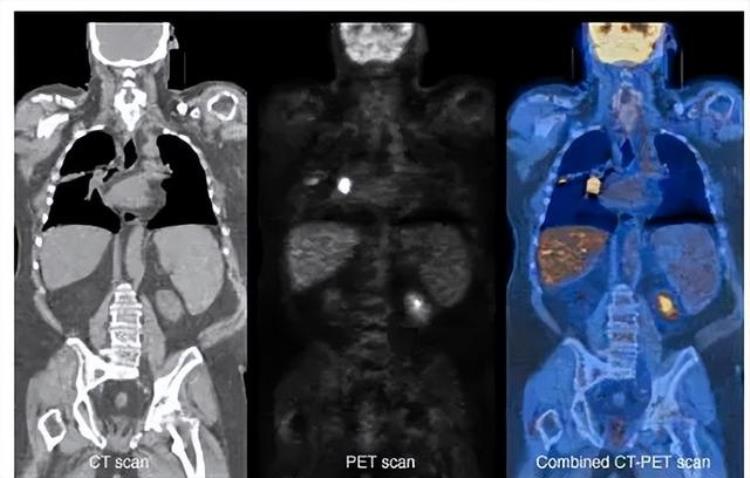 ct检查什么比较好「CTMRIPETCT哪种检查适合你看完你就知道性价比」
