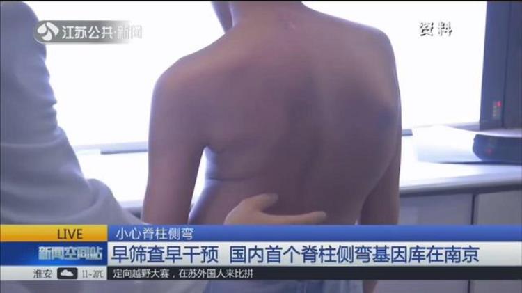 人老了为什么驼背「人老了为啥会驼背脊椎专家50岁后注意这一点让你腰倍儿直」