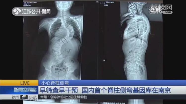 人老了为什么驼背「人老了为啥会驼背脊椎专家50岁后注意这一点让你腰倍儿直」