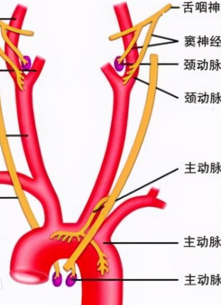 胸痛的四大元凶之首主动脉夹层这样的胸痛必须早确诊早治疗