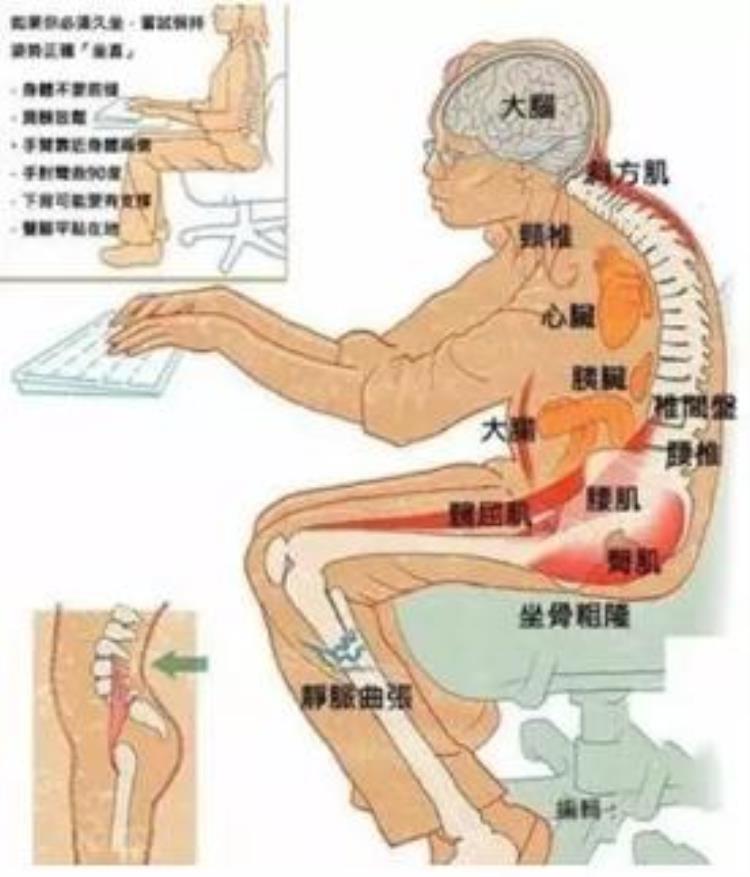 腹部训练背疼「想要练肚子结果背疼了你的问题在这里」