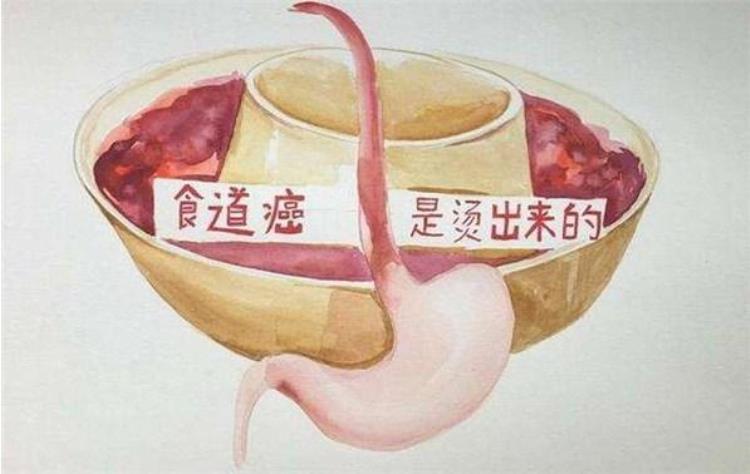 诱发食管癌的八大因素「诱发食管癌的八大因素」