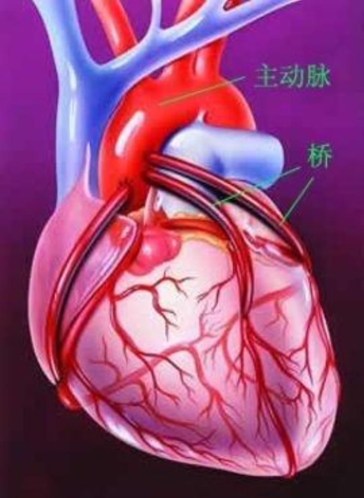 心脏搭桥手术后浑身没劲怎么回事「心脏搭桥术后200天了感觉越来越没有力气到底怎么回事」