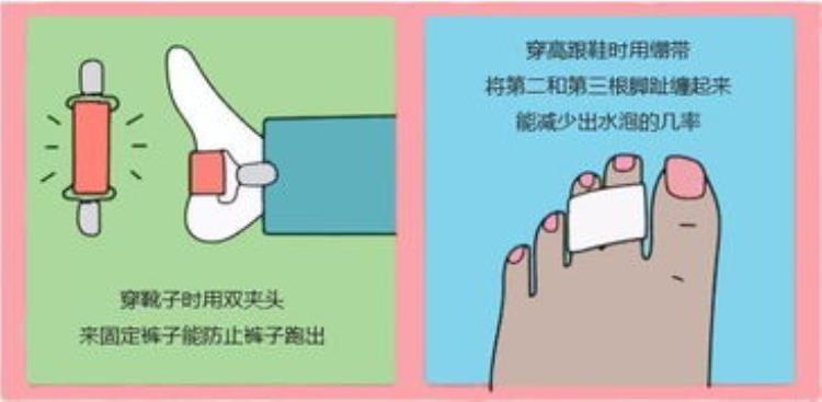 腿酸没劲可能存在这些诱因吗「腿酸没劲可能存在这些诱因」