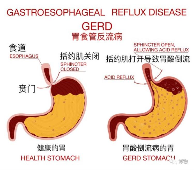 空腹饿的想吐「为啥饿到肚子空空时反倒想吐」