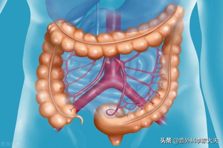 结肠癌的结局「结肠癌有没有终身不复发的」