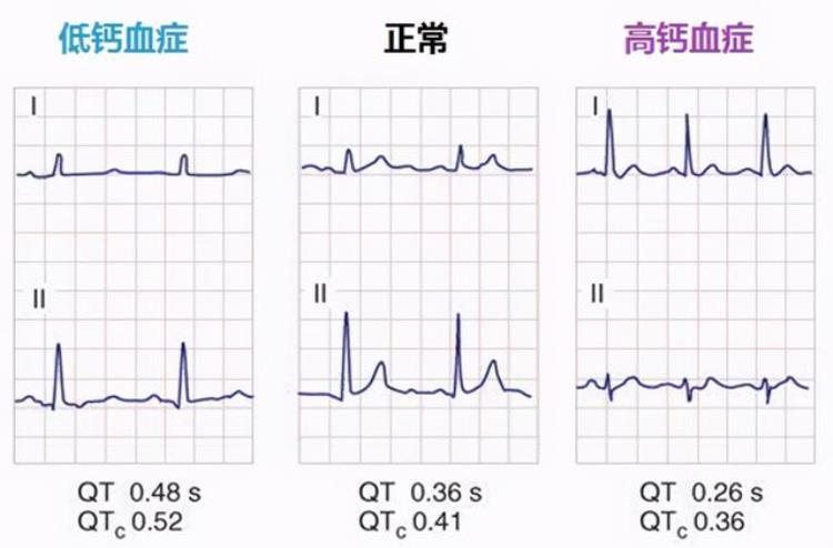 以为是关节炎一查确诊肺癌骨痛时有4个特点劝你早做胸部CT