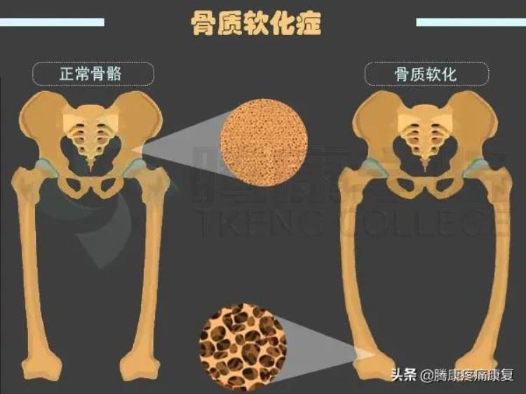 肌肉与疼痛原因诊疗预防汇总表「肌肉与疼痛原因诊疗预防汇总」