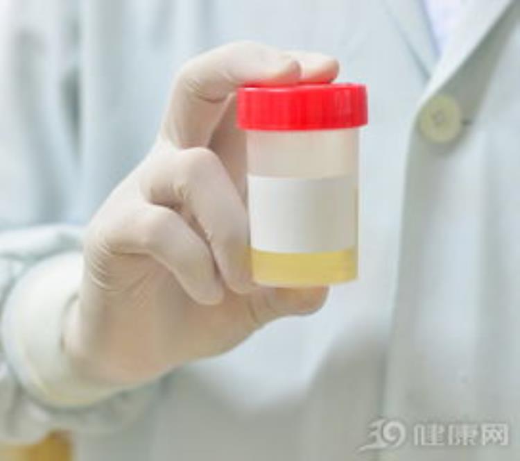 尿有泡沫是不是蛋白尿「小便出现泡沫是蛋白尿吗这4个表现提示你肾出问题了」