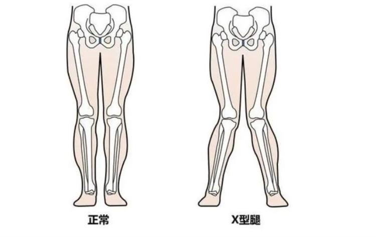 人最大的肌肉长在屁股上体态跌倒都和它有关如何增强臀肌