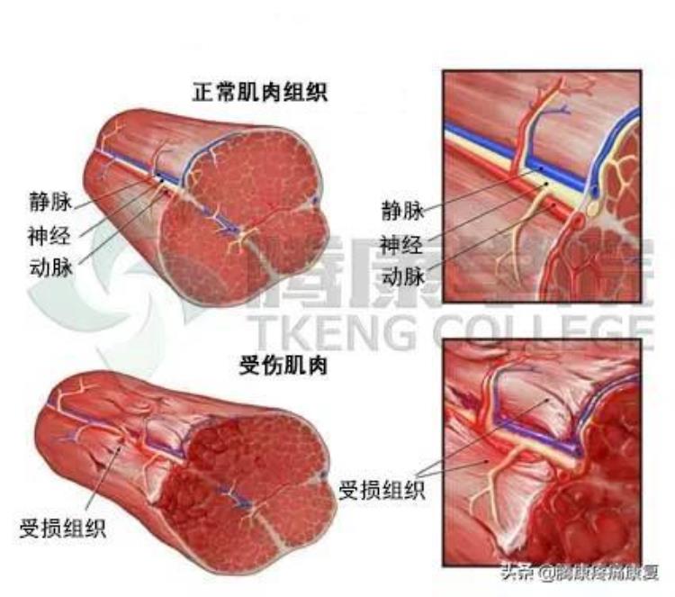 肌肉与疼痛原因诊疗预防汇总表「肌肉与疼痛原因诊疗预防汇总」