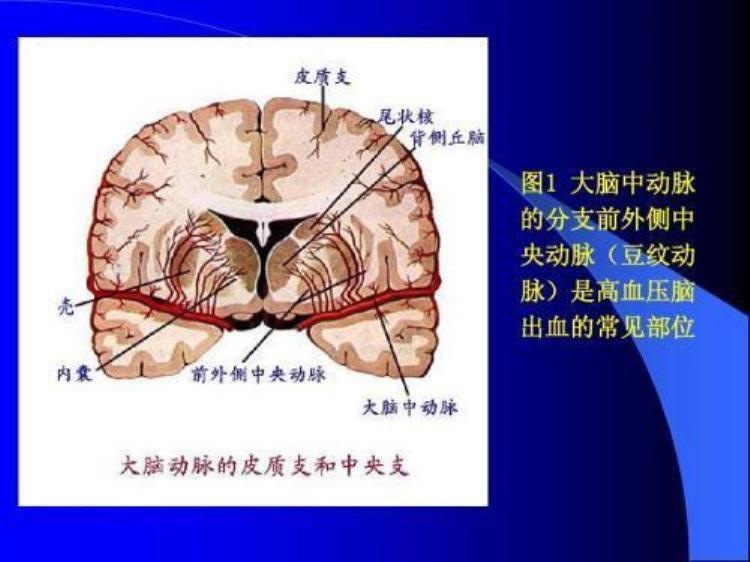 伤寒并发症有哪些( )「伤寒可以并发哪些疾病小心这4个疾病的侵袭切勿大意」