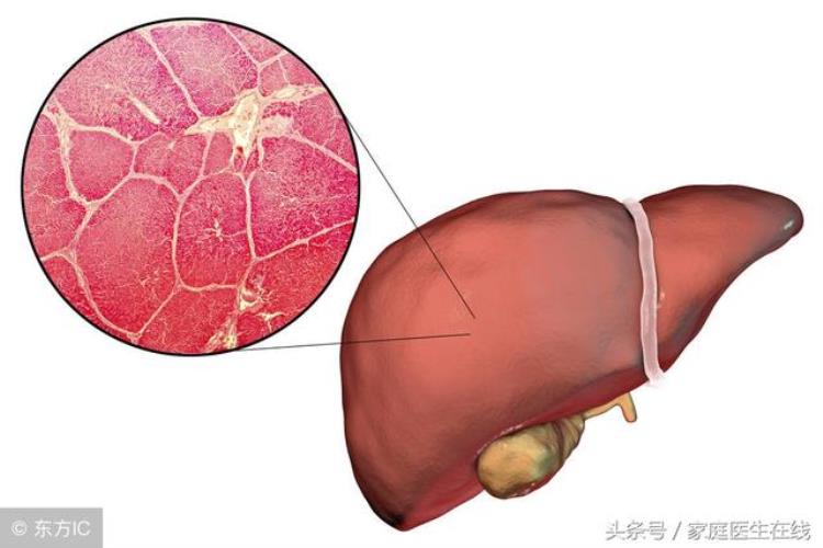 紫菜会掉色「泡发紫菜时掉色就是被染色也有可能是这种情况」