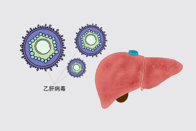 直肠癌大便有什么改变「直肠癌光临时大便大多会有3个变化出现2个以上需做检查」