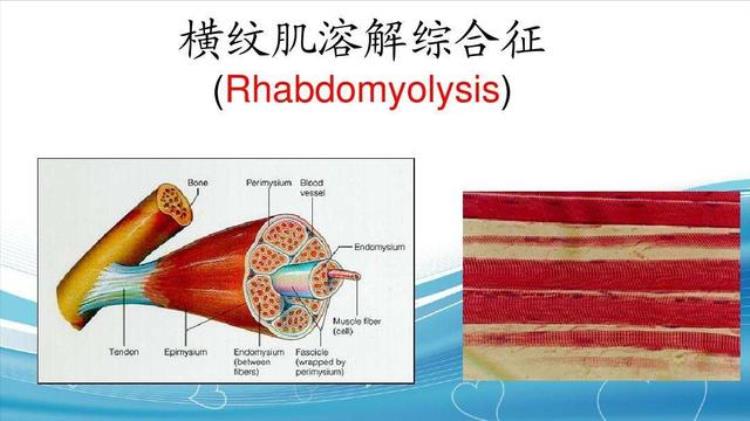 连续运动几小时肌肉会溶解「运动2小时会肌肉溶解导致死亡这样运动才健康」