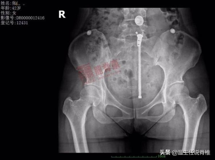 雪天路滑摔倒大腿疼「摔了一跤大腿疼」