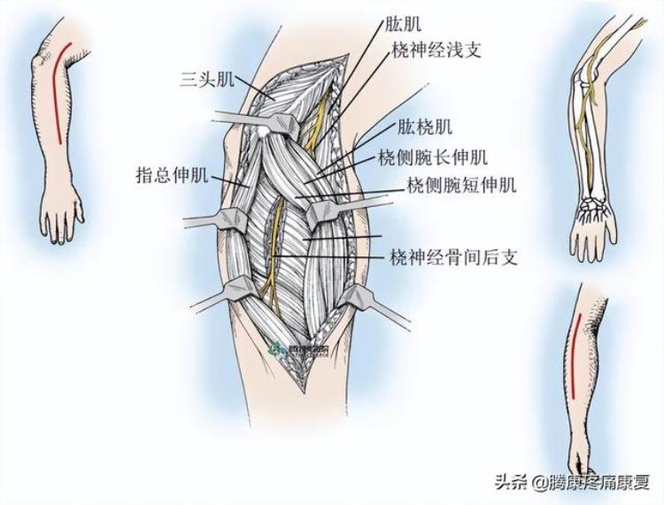 前臂疼痛怎么缓解「前臂疼痛这五个动作就能缓解」