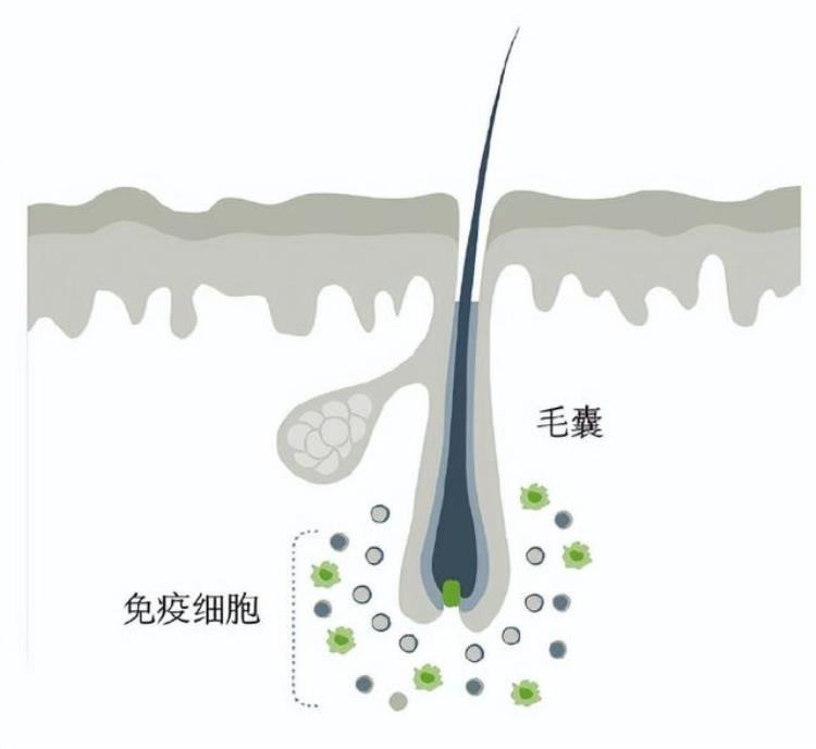 蓄势待发后「蓄势待发时秃然来袭怎么破」